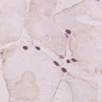 GNAT1 Antibody (Internal)