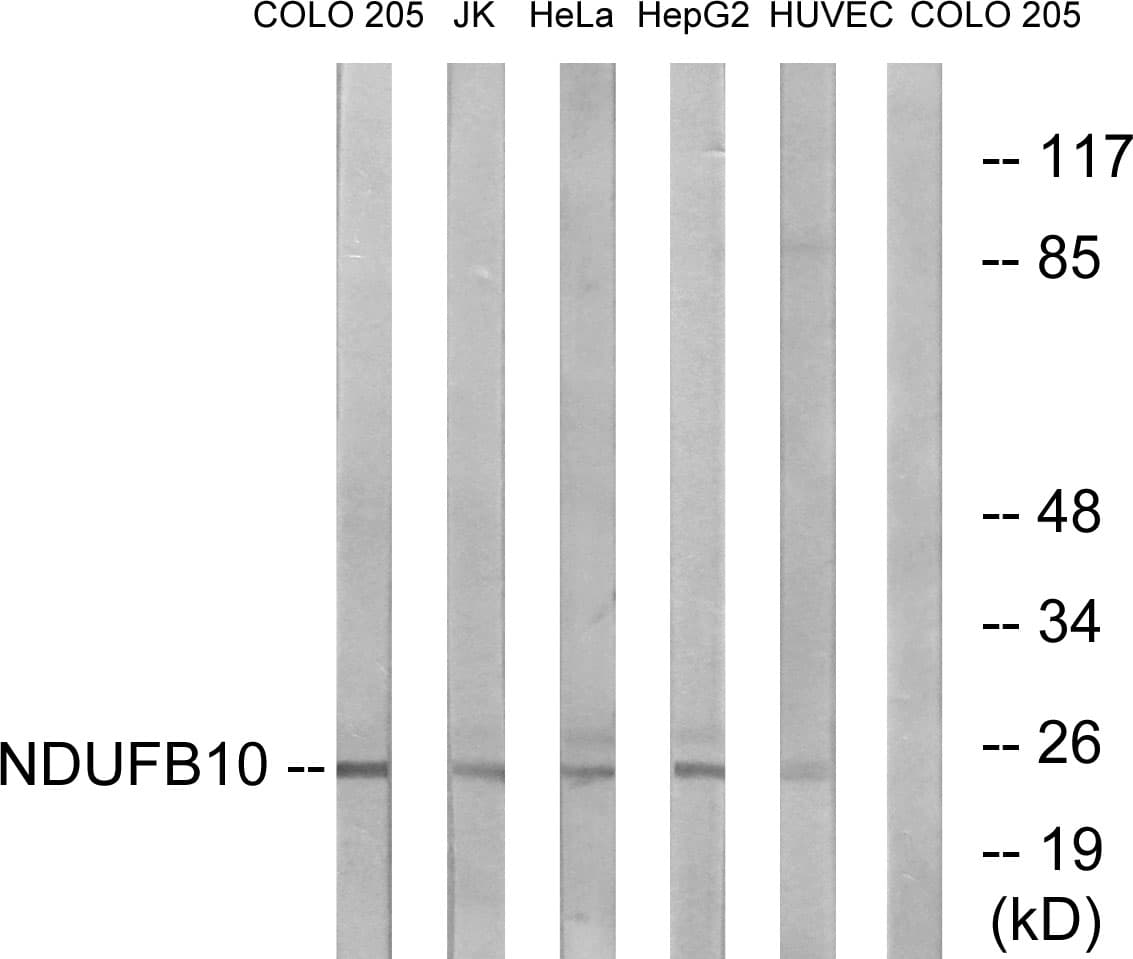 Polyclonal Rabbit anti-Human NDUFB10 Antibody (aa63-112, WB)