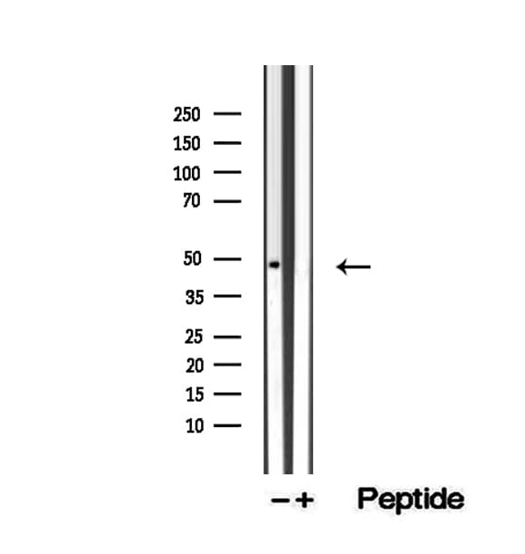 Polyclonal Rabbit anti-Human ZFYVE27 / Protrudin Antibody (IHC, WB)