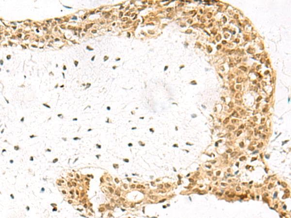 EXOSC4 / RRP41 Antibody