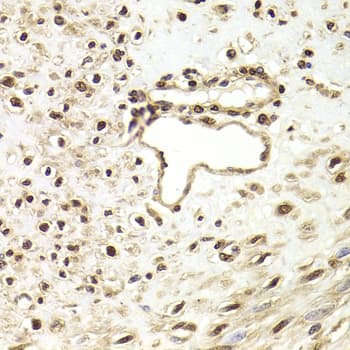 FKBP4 / FKBP52 Antibody