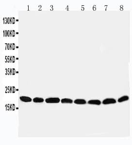 Polyclonal Rabbit anti-Human PRDX5 / Peroxiredoxin 5 Antibody (aa166-181, IHC, WB)