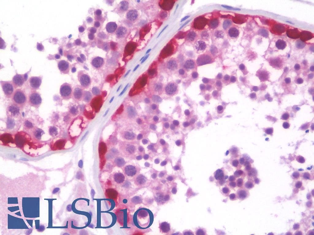 IHC-plus™ Monoclonal Mouse anti-Human MAGEA3 Antibody (clone 4E2, IHC, WB)