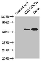 Polyclonal Rabbit anti-Human CALCOCO2 Antibody (IHC, WB)