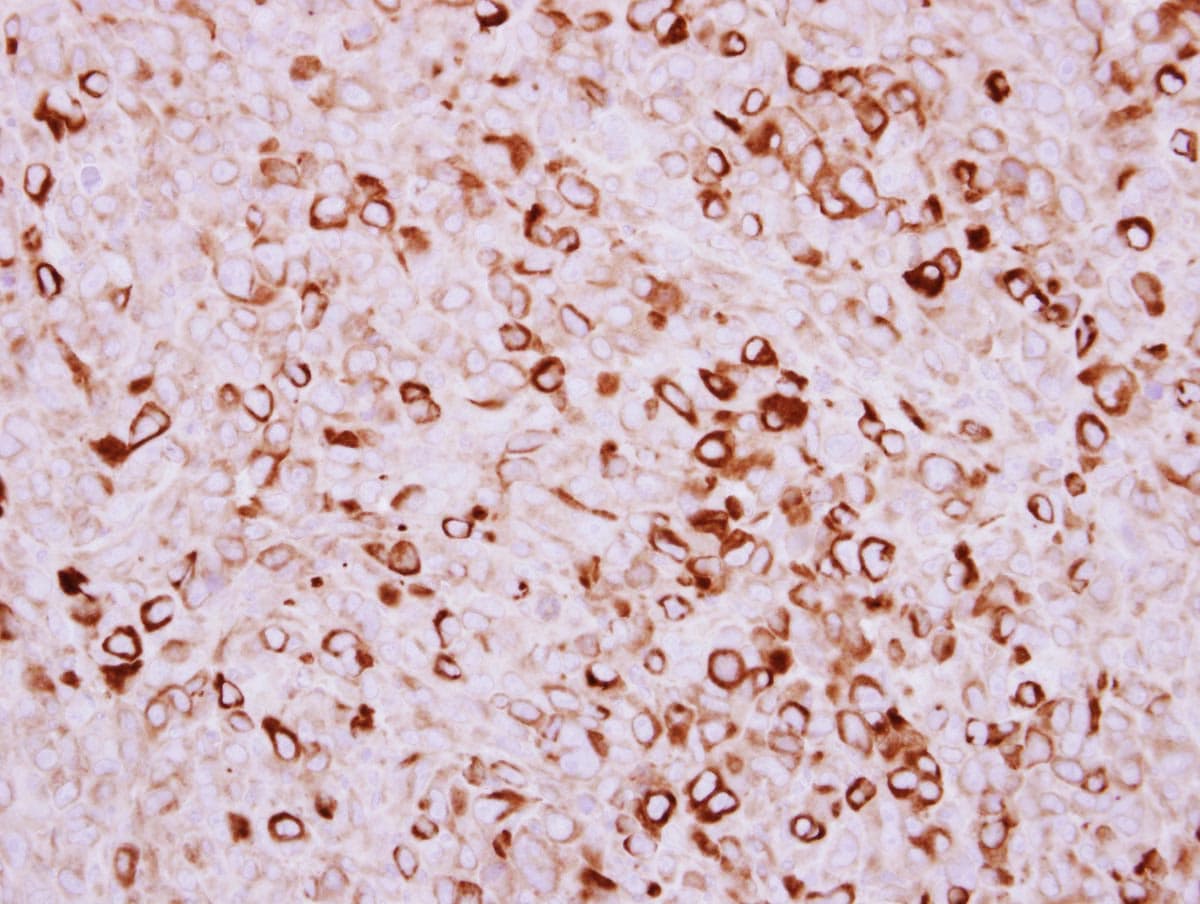 Polyclonal Rabbit anti-Human TMPRSS11D / HAT Antibody (IHC, WB)
