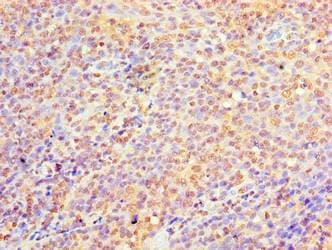 Polyclonal Rabbit anti-Human C9orf163 Antibody (aa1-203, IHC)