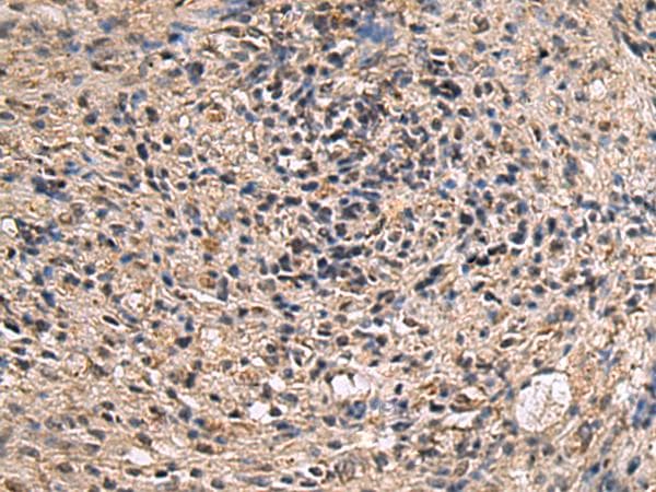 ITIH2 Antibody