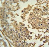 SYN3 / Synapsin III Antibody (aa363-388)