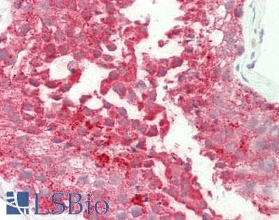 Polyclonal Rabbit anti-Mouse GYG1 / Glycogenin Antibody (C-Terminus, IHC, WB)