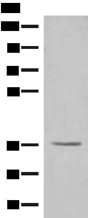 GAL4 / Galectin 4 Antibody