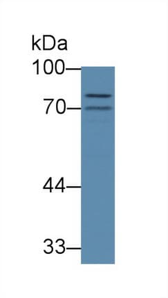 ABCB8 Antibody (APC)