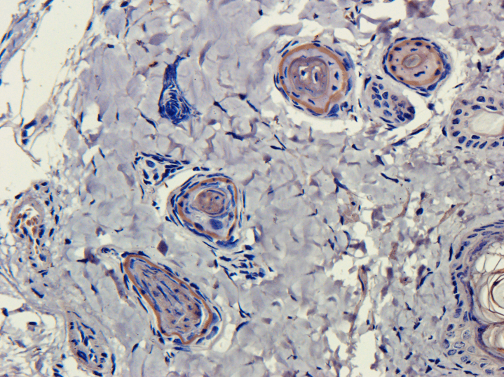 CD4 Antibody (CD4, clone MT310)