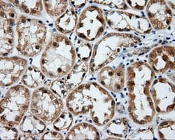 BTK Antibody (clone OTI1H7)
