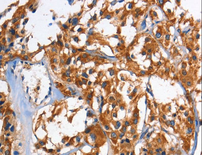 Polyclonal Rabbit anti-Human HK2 / Hexokinase 2 Antibody (IHC, WB)