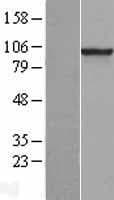 Human PDE6B / PDE6 Beta Protein (Over-Expression Lysate Myc-DDK (Flag))