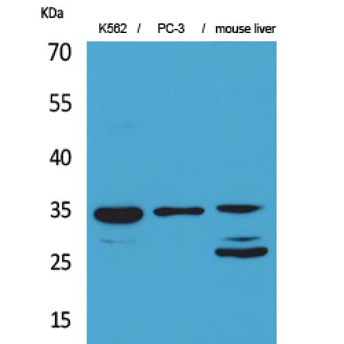 Polyclonal Rabbit anti-Human CDC34 Antibody (111-160 aa, Internal, WB)