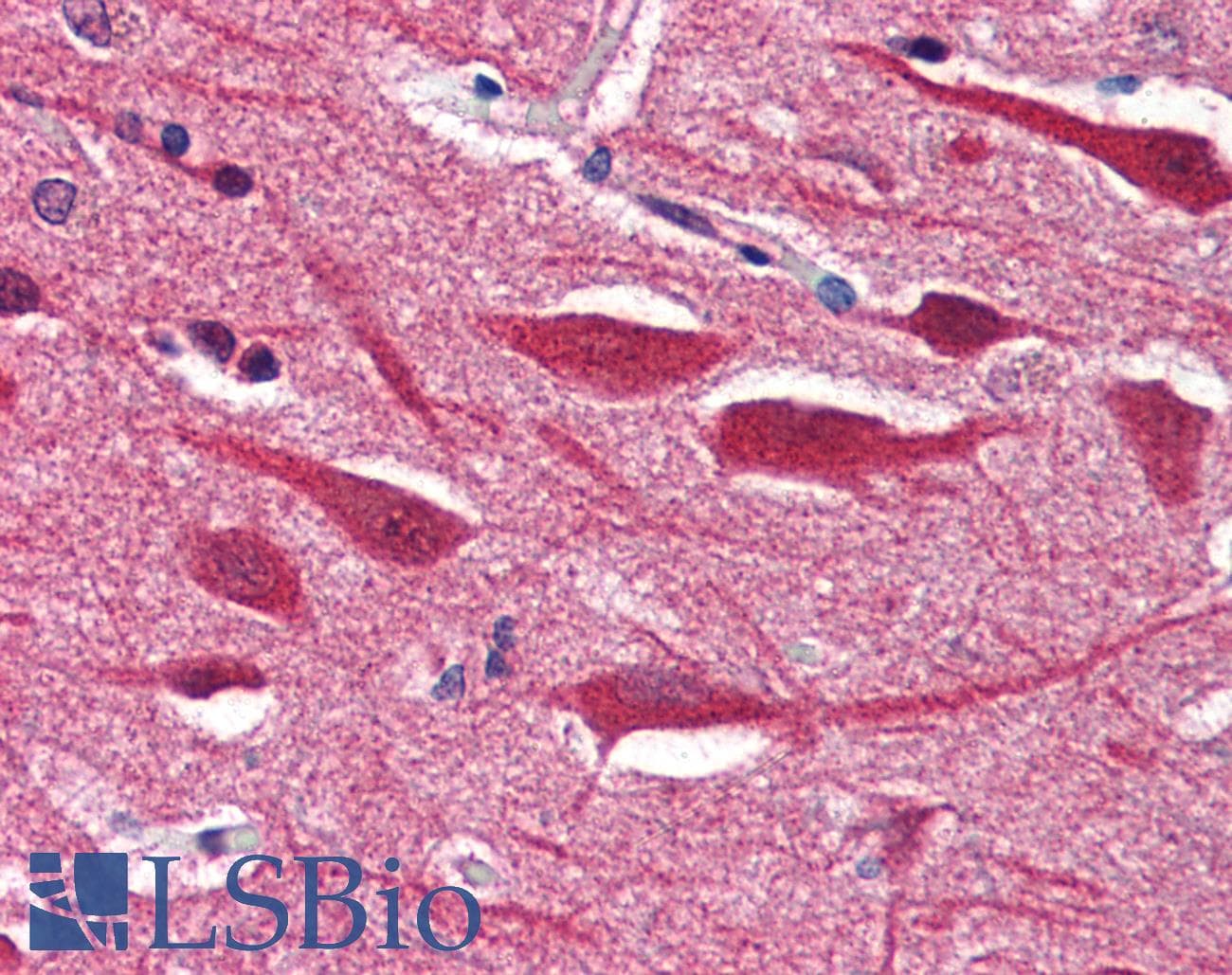 IHC-plus™ STX2 / Syntaxin 2 Antibody (aa1-19)