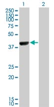 IHC-plus™ CAMK1D Antibody (clone 3H8)