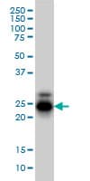 IHC-plus™ CREG / CREG1 Antibody (clone 1B7)