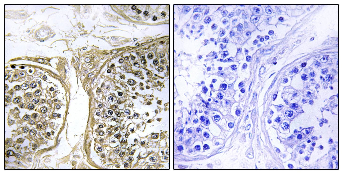 Polyclonal Rabbit anti-Human CYP2C8 Antibody (IHC)