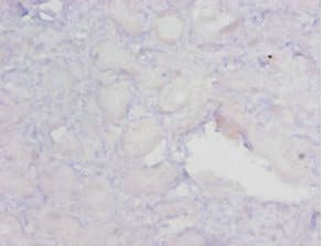MGMT Antibody