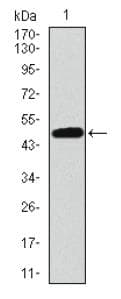 Monoclonal Mouse anti-Human TP53BP1 / 53BP1 Antibody (clone 6B3E10, aa500-800, IHC, WB)