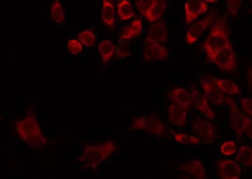 MRPL22 Antibody