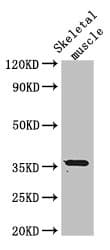 EPM2A / Laforin Antibody