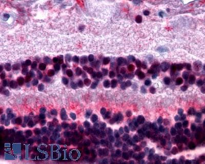 PathPlus™ Polyclonal Rabbit anti-Human MTNR1B / MT2 Antibody (Extracellular Domain, IHC)