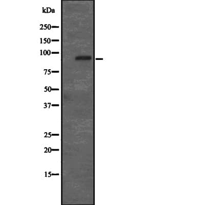 Polyclonal Rabbit anti-Human RP105 / CD180 Antibody (IHC, WB)