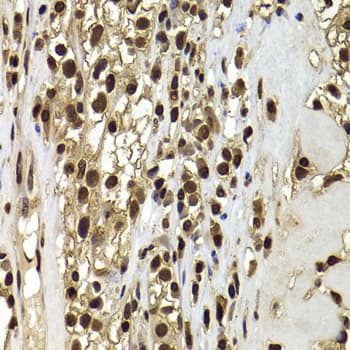 Polyclonal Rabbit anti-Human BAF53B / ACTL6B Antibody (IHC, IF, WB)