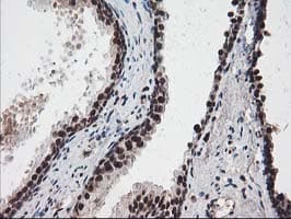 NUDT18 Antibody (clone OTI5D7)