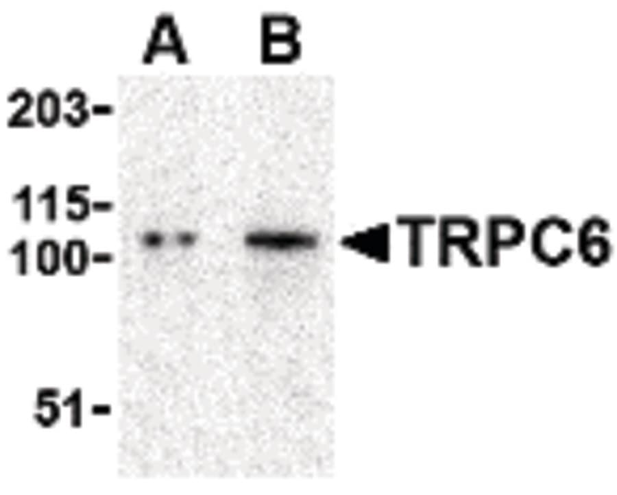 Polyclonal Rabbit anti-Human TRPC6 Antibody (IHC, IF, WB)