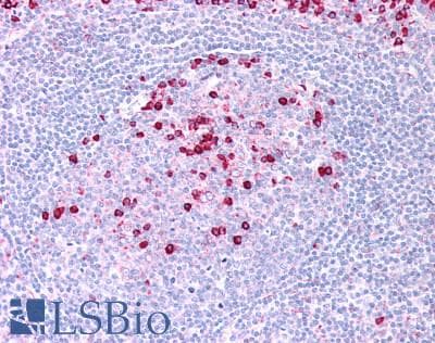 PathPlus™ KCNJ2 / Kir2.1 Antibody (Internal)