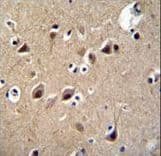 Polyclonal Rabbit anti-Human LRTM2 Antibody (aa339-367, IHC, IF, WB)
