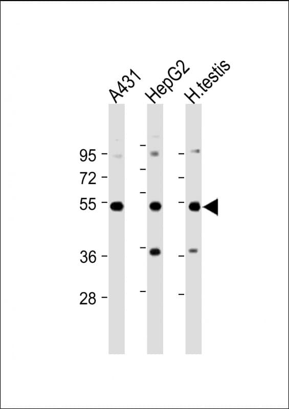 STK25 Antibody