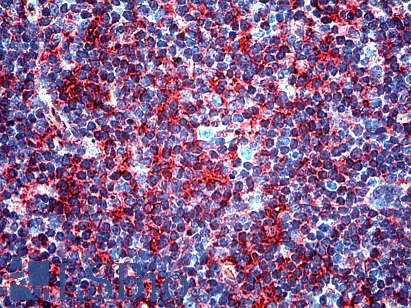 IHC-plus™ TGF-Beta Antibody (clone TB21)