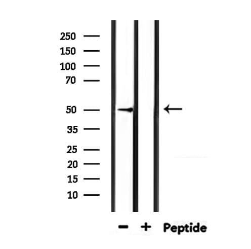 Polyclonal Rabbit anti-Human HTR3D / 5HT3D Receptor Antibody (IF, WB)