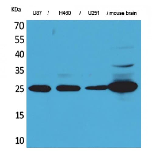 UCHL1 / PGP9.5 Antibody (31-80 aa, Internal)