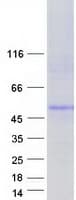 Human CTNS / Cystinosin Protein (Recombinant Myc-DDK (Flag))