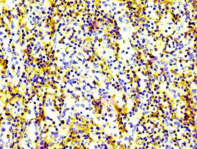 Recombinant Monoclonal Rabbit anti-Human ADGRE5 / CD97 Antibody (IHC, IF)