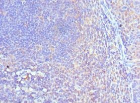 Polyclonal Rabbit anti-Human CUL5 / Cullin-5 Antibody (aa1-300, IHC)