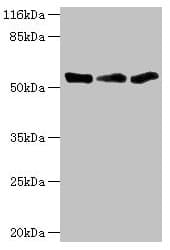Polyclonal Rabbit anti-Human TFCP2 / CP2 Antibody (IHC, WB)