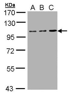 IHC-plus™ Polyclonal Rabbit anti-Human CD71 / Transferrin Receptor Antibody (IHC, WB)