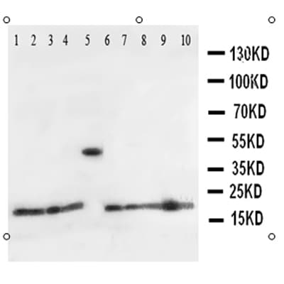 Polyclonal Rabbit anti-Human Ribonuclease A / RNASE1 Antibody (aa72-90, WB)