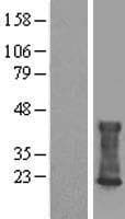 CMTM6 / CKLFSF6 Protein (Over-Expression Lysate Myc-DDK (Flag))