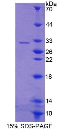 Rat GBP2 Protein (Recombinant His-T7, N-terminus)