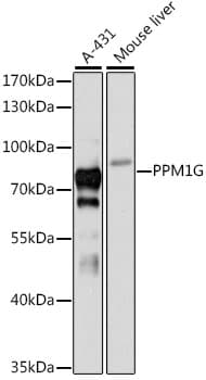 PPM1G Antibody