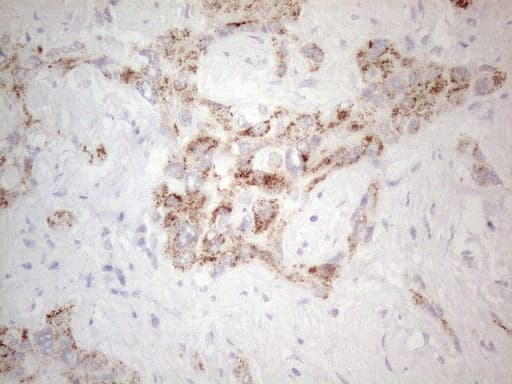 AMACR / P504S Antibody (clone OTI2E3)