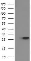 15-PGDH / HPGD Antibody (clone OTI1C10)